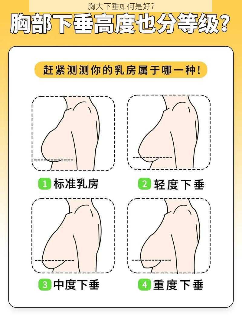 胸大下垂如何是好？